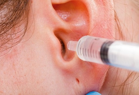 Il lavaggio del canale uditivo, è un trattamento molto semplice che viene effettuato dopo aver ammorbidito il cerume con delle specifiche gocce emollienti.